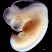 Эмбрион 6 недель