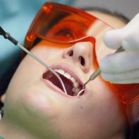 процес пломбирования зубов