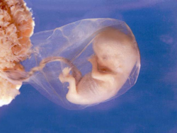 эмбрион 8 недель