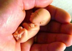 осложнения искусственного аборта