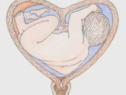 Матка седловидной формы и беременность