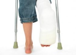 перелом пальца ноги лечение