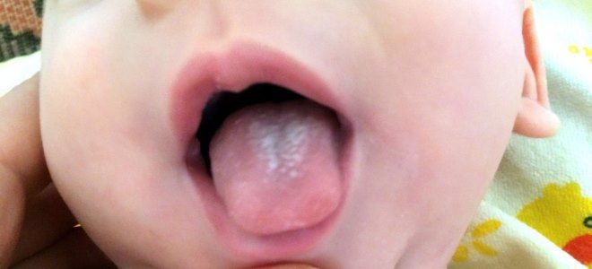 воспаление слизистой оболочки рта