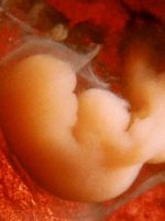 Размеры эмбриона по неделям - таблица